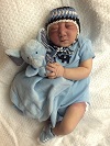 Shane Michael, baby with anencephaly