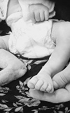 Stephanie Grace, baby with anencephaly