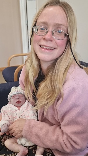 Stephanie Grace, baby with anencephaly