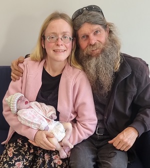 Stephanie Grace, baby with anencephaly