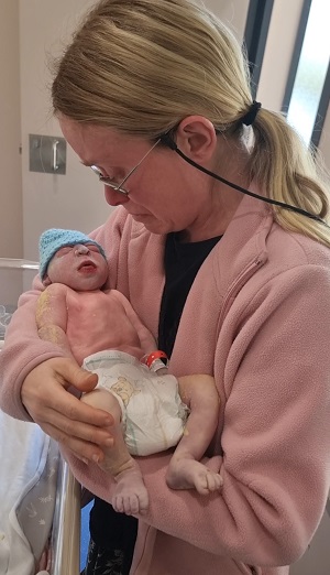 Stephanie Grace, baby with anencephaly