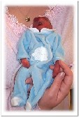 Timothy Paul, baby with anencephaly