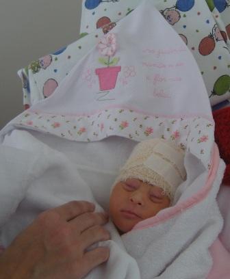 Vitoria, baby with anencephaly