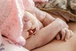 Wendy Belle, baby with anencephaly